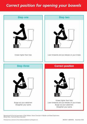 Pump replika Skuffelse Women's Health Physiotherapy Adelaide: How Should You Sit on the Toilet? -  myPhysioSA