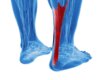 achilles pain physiotherapy